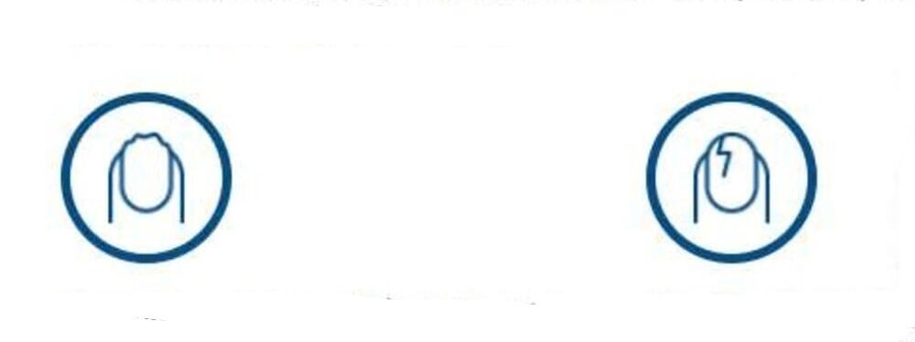 deformace nehtů v důsledku houbové infekce